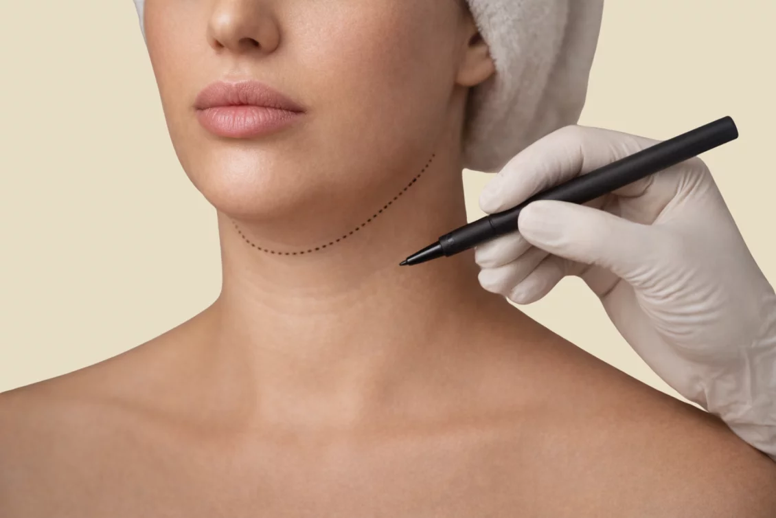 Doppelkinn entfernen in Berlin