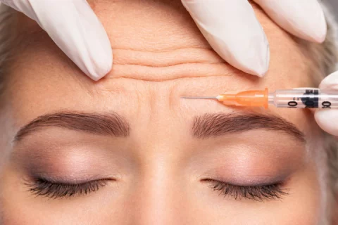 Stirnfalten entfernen Berlin